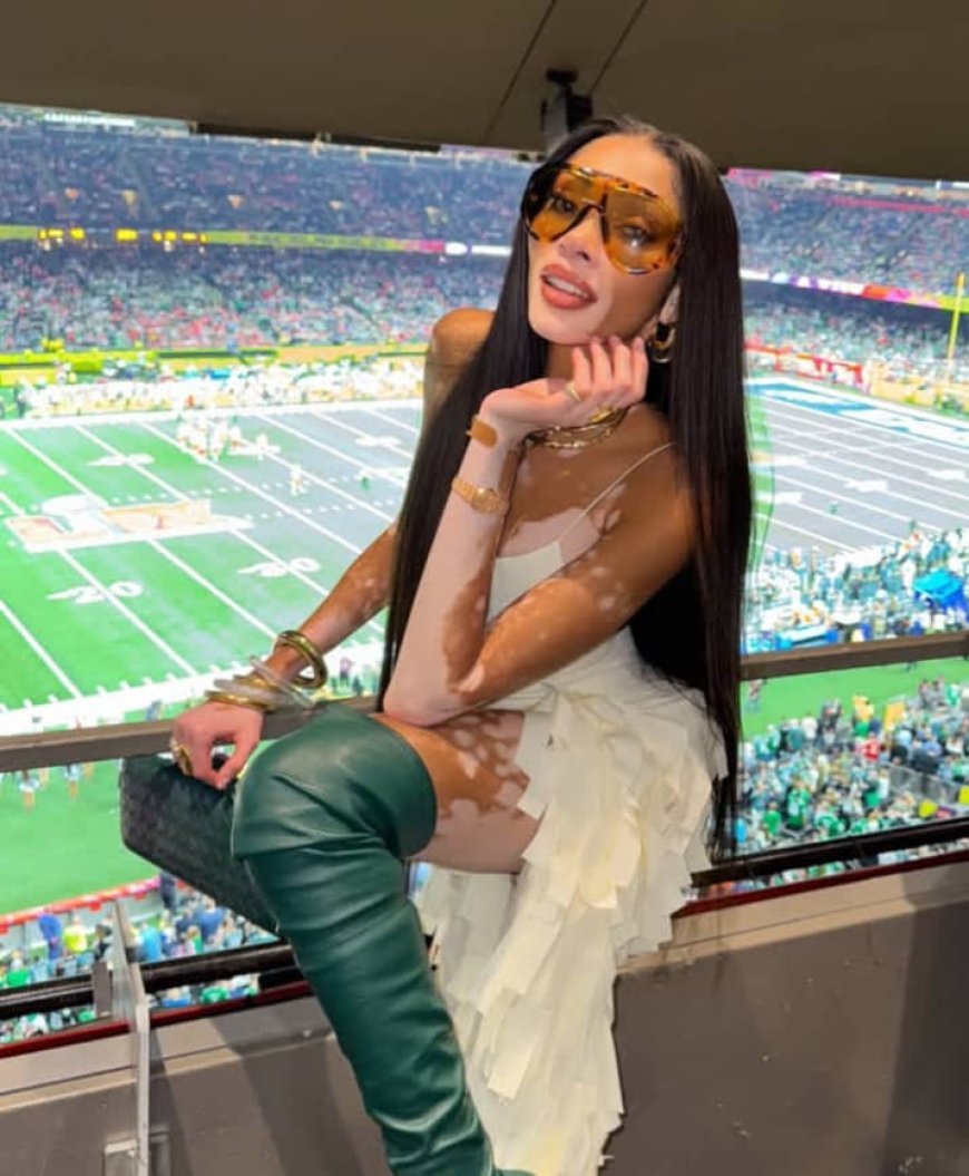 Winnie Harlow: From America’s Next Top Model to Global Fashion Icon and Vitiligo Advocate